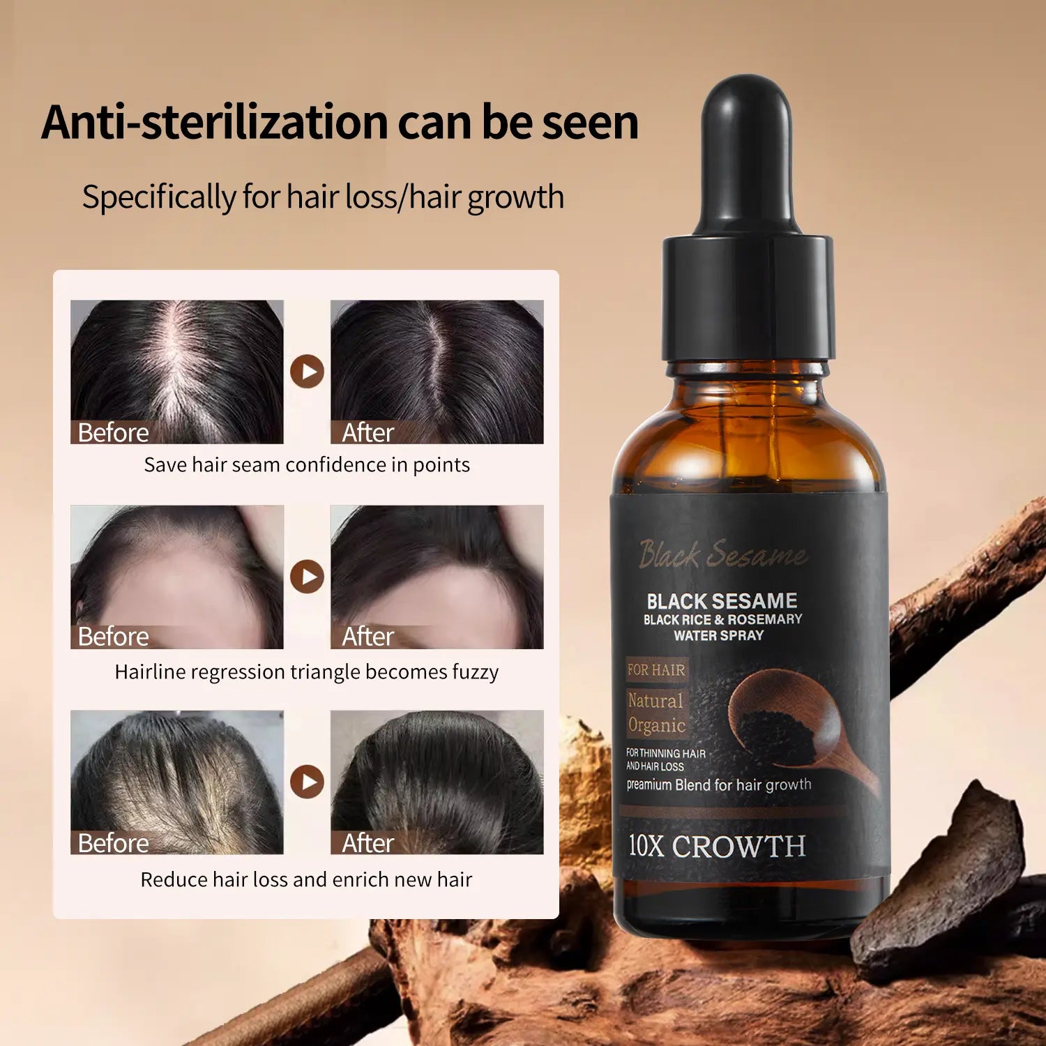 【Fda-Approved Hair Growth Essence】Rich in Natural Ingredients like Black Sesame and Rosemary, This Essence Nourishes Your Scalp and Promotes the Growth of Healthy Hair. |Hair Growth|Hair Loss|Hair Care|Hair Growth Essence|Hair Tonic