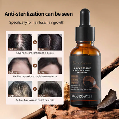 【Fda-Approved Hair Growth Essence】Rich in Natural Ingredients like Black Sesame and Rosemary, This Essence Nourishes Your Scalp and Promotes the Growth of Healthy Hair. |Hair Growth|Hair Loss|Hair Care|Hair Growth Essence|Hair Tonic